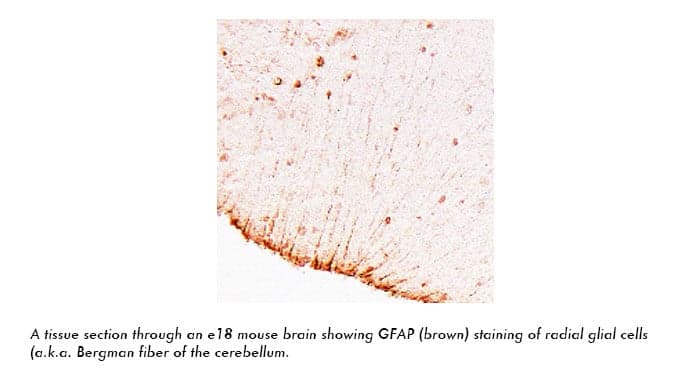 Anti-GFAP(Chicken )
