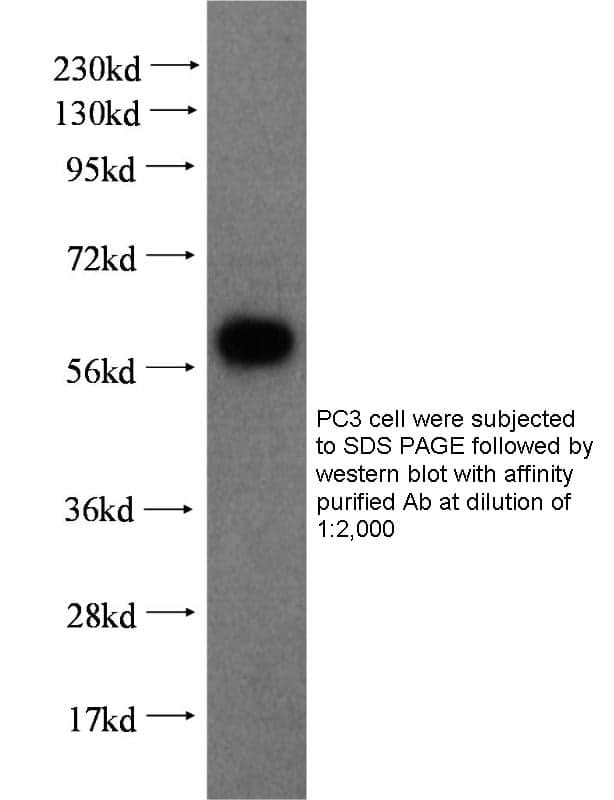 Anti Human CX3CL1 Polyclonal