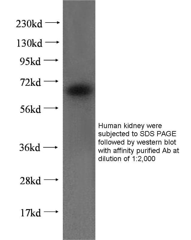 Anti Human TGFBI Polyclonal