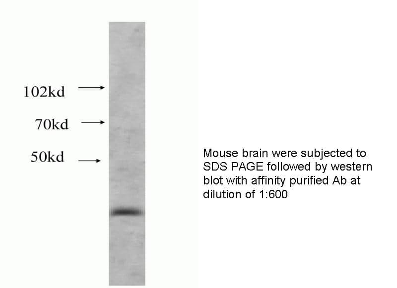 Anti Human HSPBP1 Polyclonal
