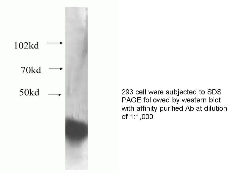 Anti Human NFKBIA Polyclonal