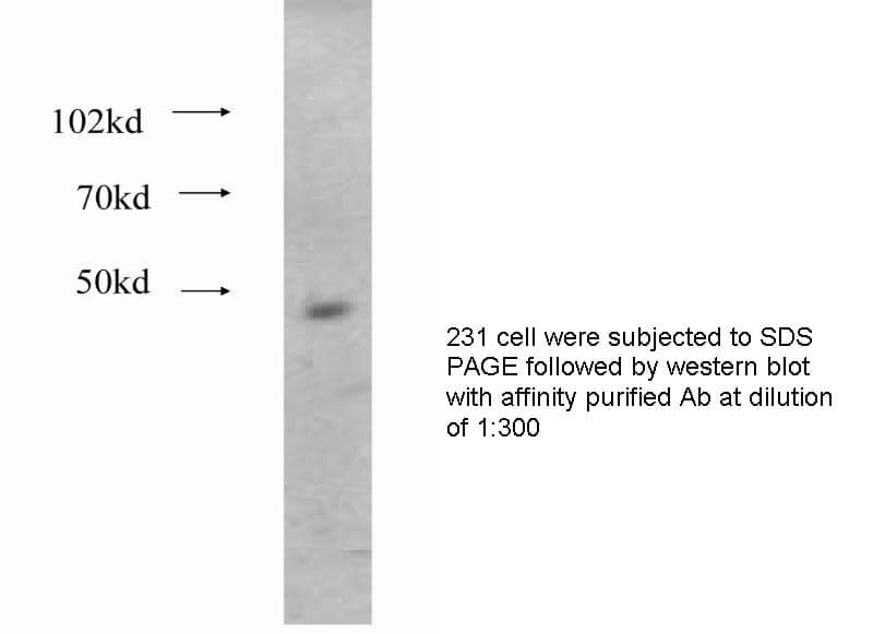 Anti Human STK6,STK15 Polyclonal