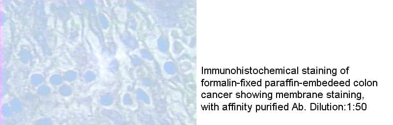 Anti Human MMP1 Polyclonal
