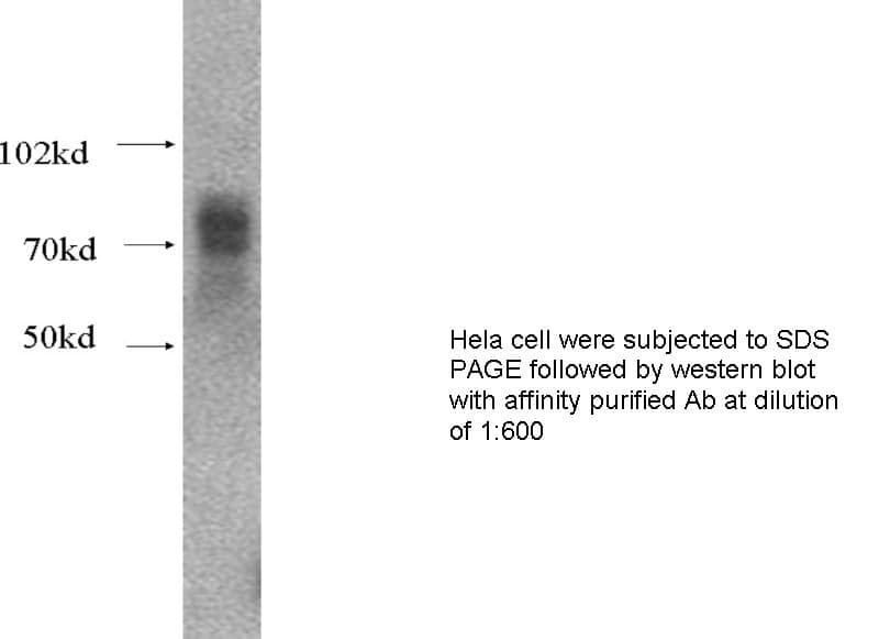 Anti Human MMP2 Polyclonal