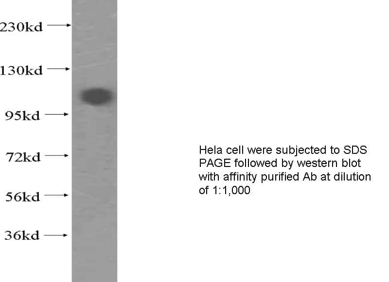 Anti Human CARD14 Polyclonal