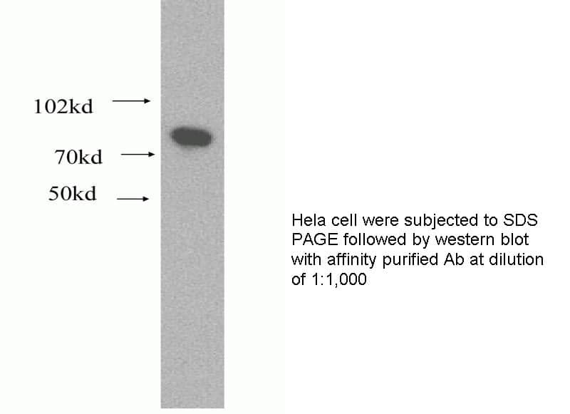Anti Human CEACAM5 Polyclonal