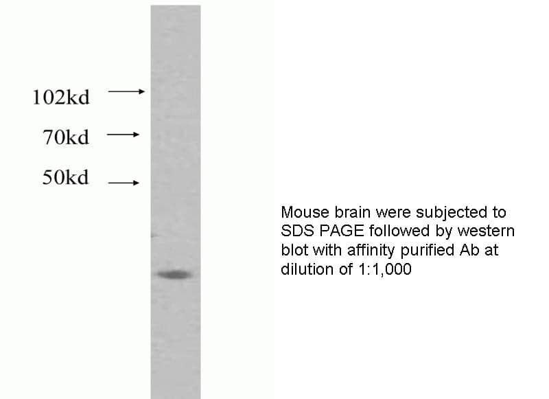 Anti Human CDK5 Polyclonal