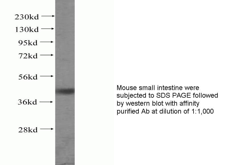 Anti Human DUSP6 Polyclonal