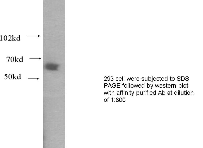 Anti Human WHSC2 Polyclonal