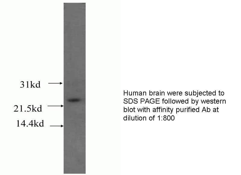 Anti Human STARD5 Polyclonal