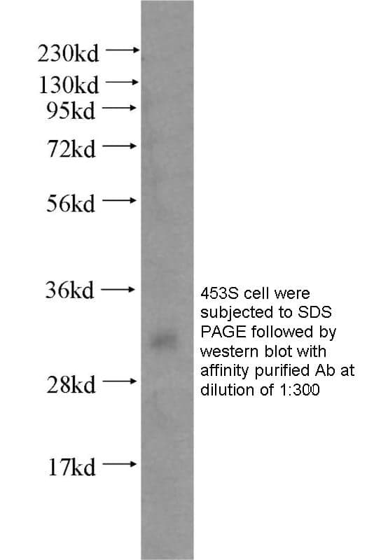 Anti Human LASP1 Polyclonal