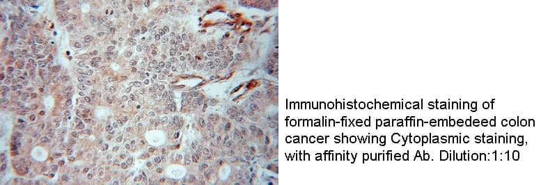 Anti Human CKS1B Polyclonal