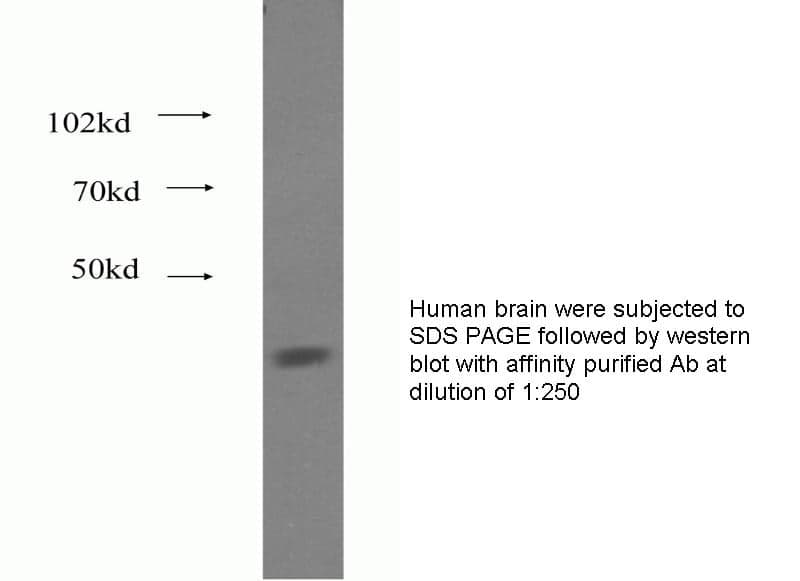 Anti Human FADS1 Polyclonal