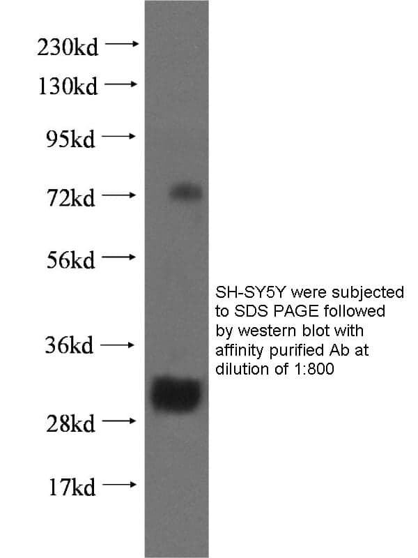 Anti Human EEF1D Polyclonal
