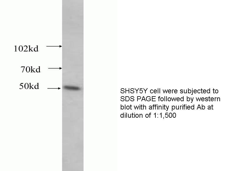 Anti Human DLK1 Polyclonal