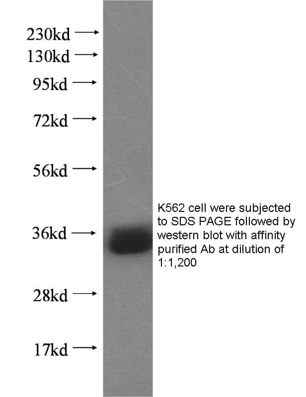 Anti Human REDD1 Polyclonal