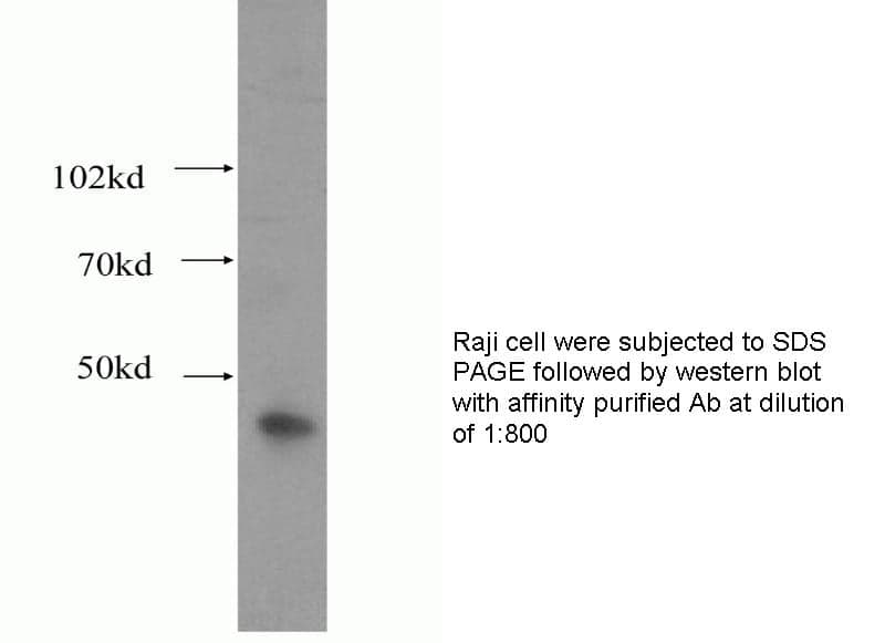 Anti Human LAMR1 Polyclonal