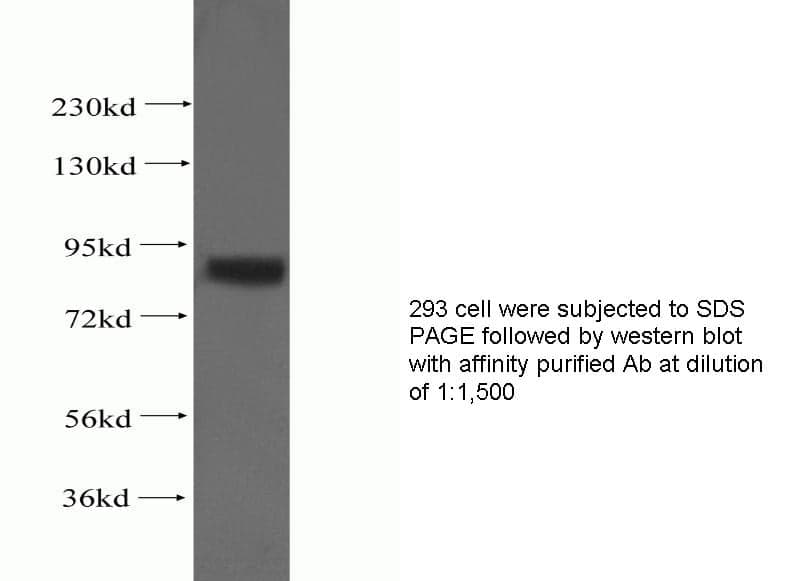Anti Human SPHK1 Polyclonal