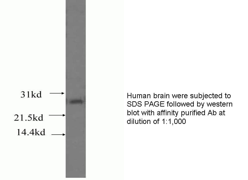 Anti Human TNFSF13 Polyclonal