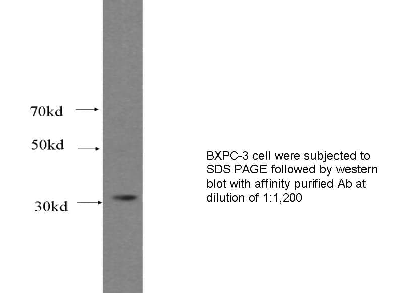 Anti Human SIX1 Polyclonal