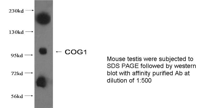 Anti Human COG1 Polyclonal