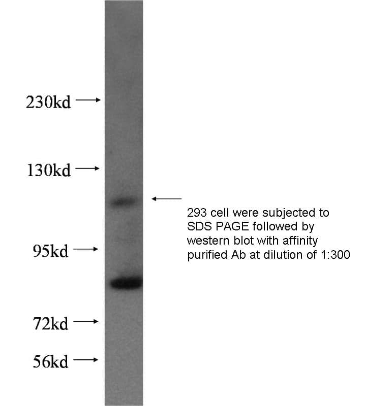 Anti Human HPS3 Polyclonal