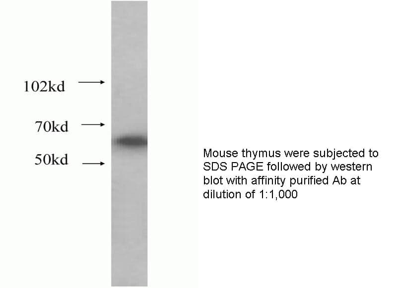 Anti Human MSF Polyclonal