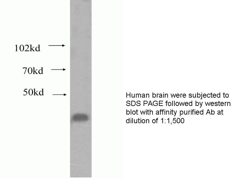Anti Human BLVRA Polyclonal