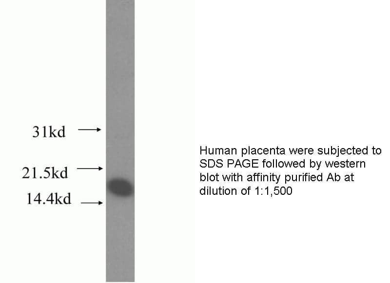 Anti Human COTL1 Polyclonal