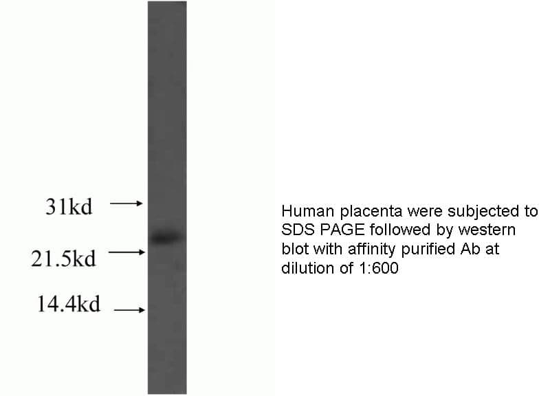 Anti Human ASF1A Polyclonal