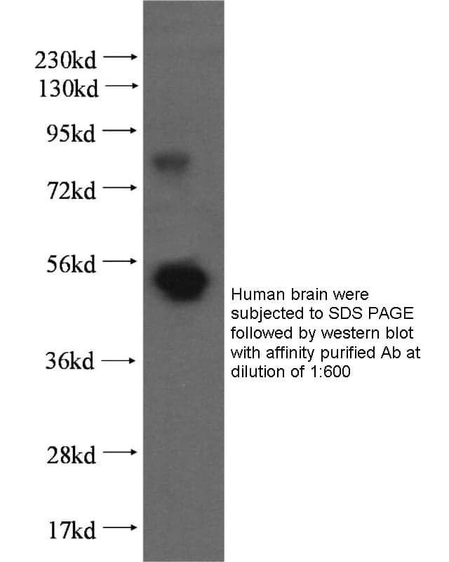 Anti Human TRIM9 Polyclonal