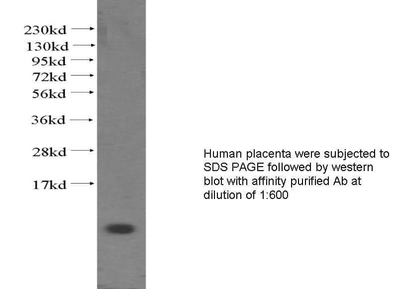 Anti Human CXCL5 Polyclonal