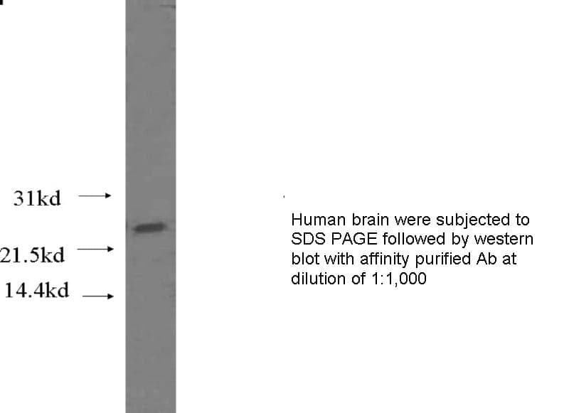 Anti Human HMGB1 Polyclonal