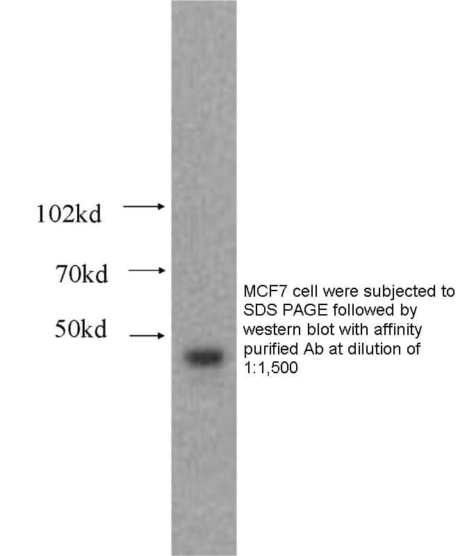 Anti Human ATF4 Polyclonal