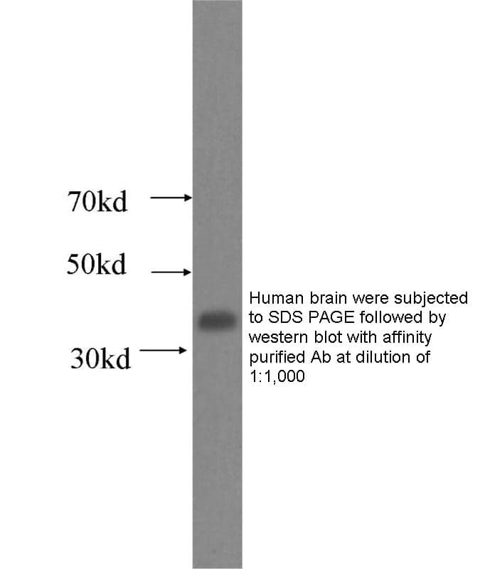 Anti Human TADA3L Polyclonal