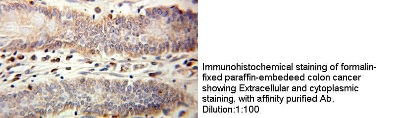 Anti Human IL1RN Polyclonal