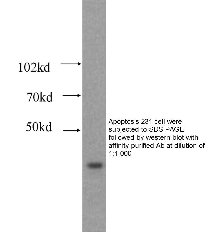 Anti Human CCND3 Polyclonal