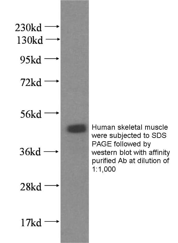 Anti Human JSRP1 Polyclonal