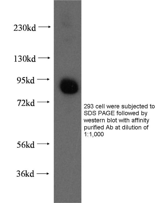 Anti Human VPS18 Polyclonal