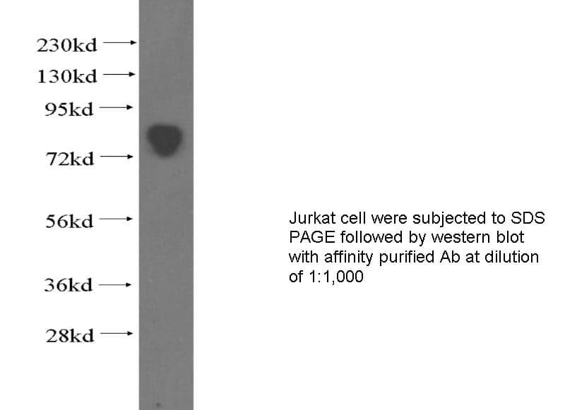 Anti Human ATP6AP2 Polyclonal