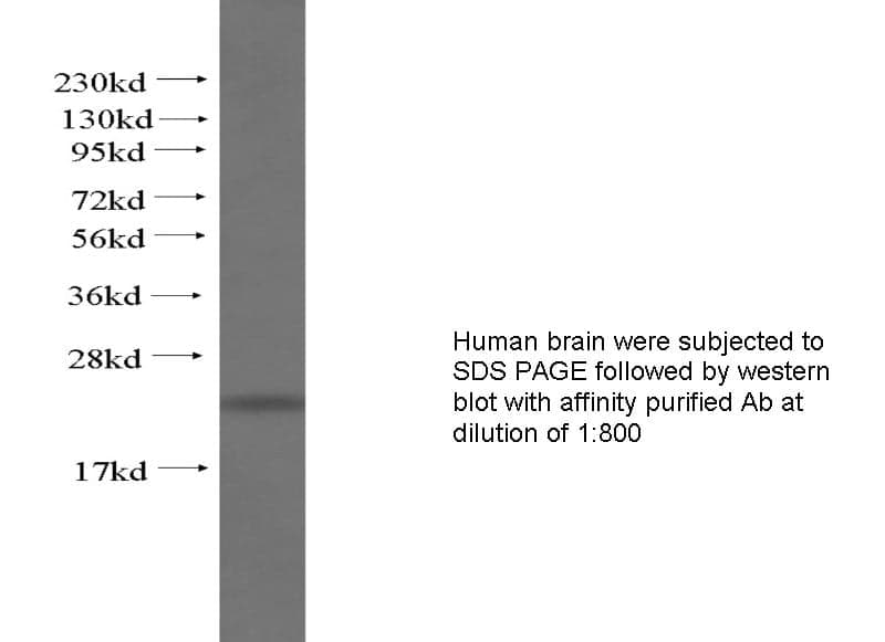 Anti Human ARPC4 Polyclonal
