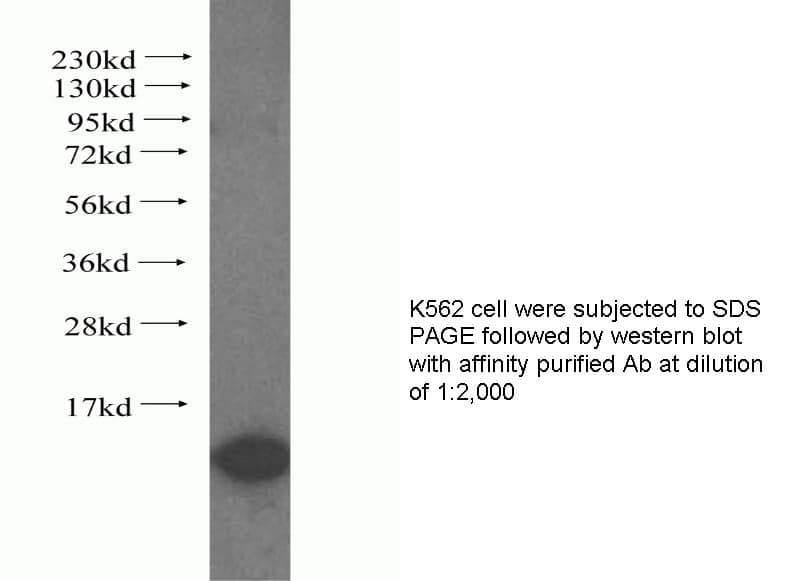 Anti Human SMT3H2 Polyclonal