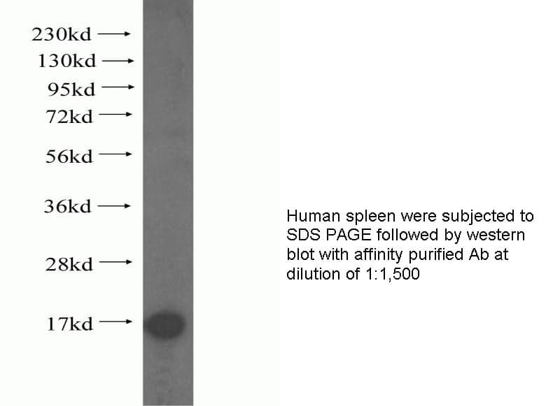 Anti Human TTC11 Polyclonal