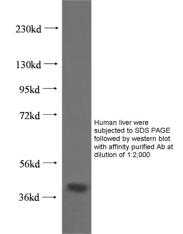 Anti Human HSD17B2 Polyclonal