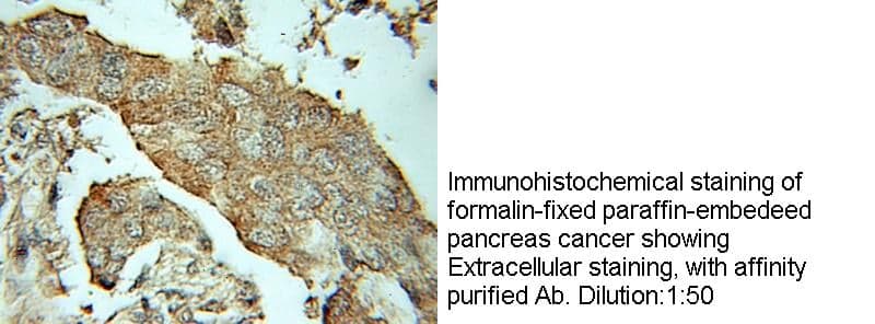 Anti Human MDK Polyclonal