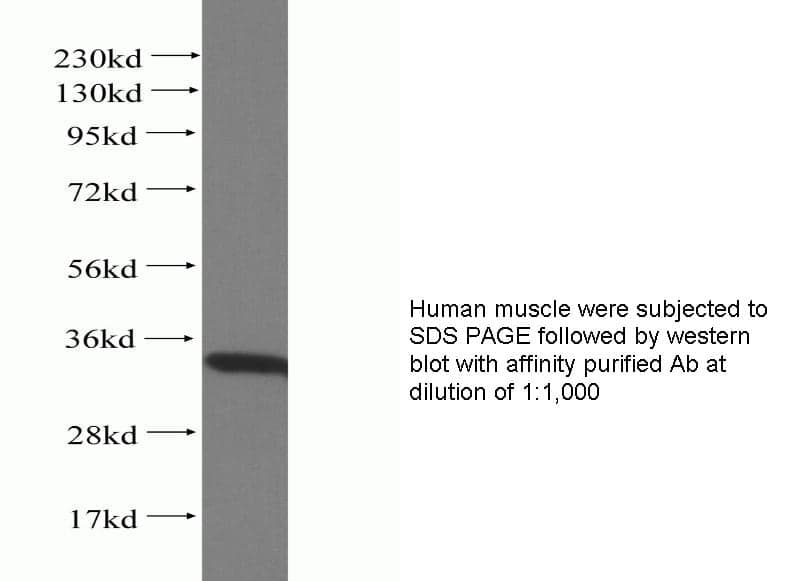 Anti Human SGT Polyclonal
