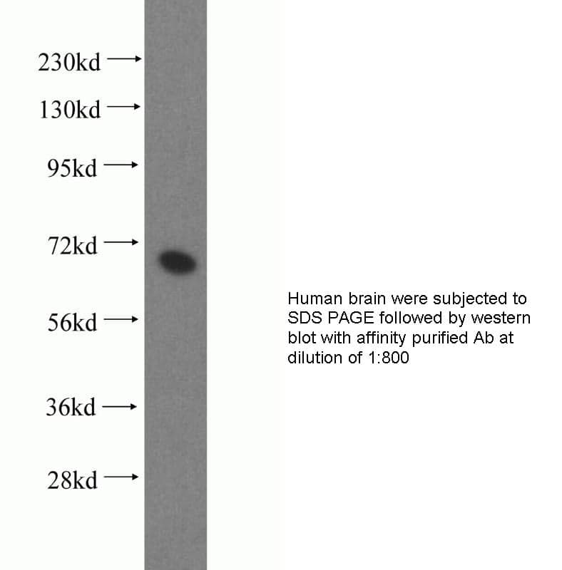Anti Human PGM2 Polyclonal