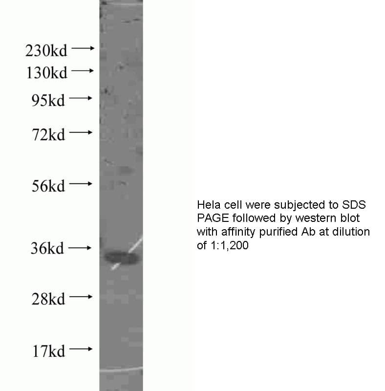 Anti Human CDK4 Polyclonal