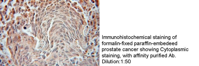 Anti Human FEM1B Polyclonal