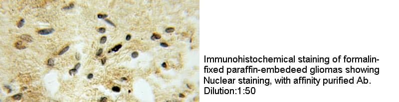 Anti Human TSNAX Polyclonal